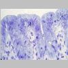 Intestino grueso SF 04.jpg
